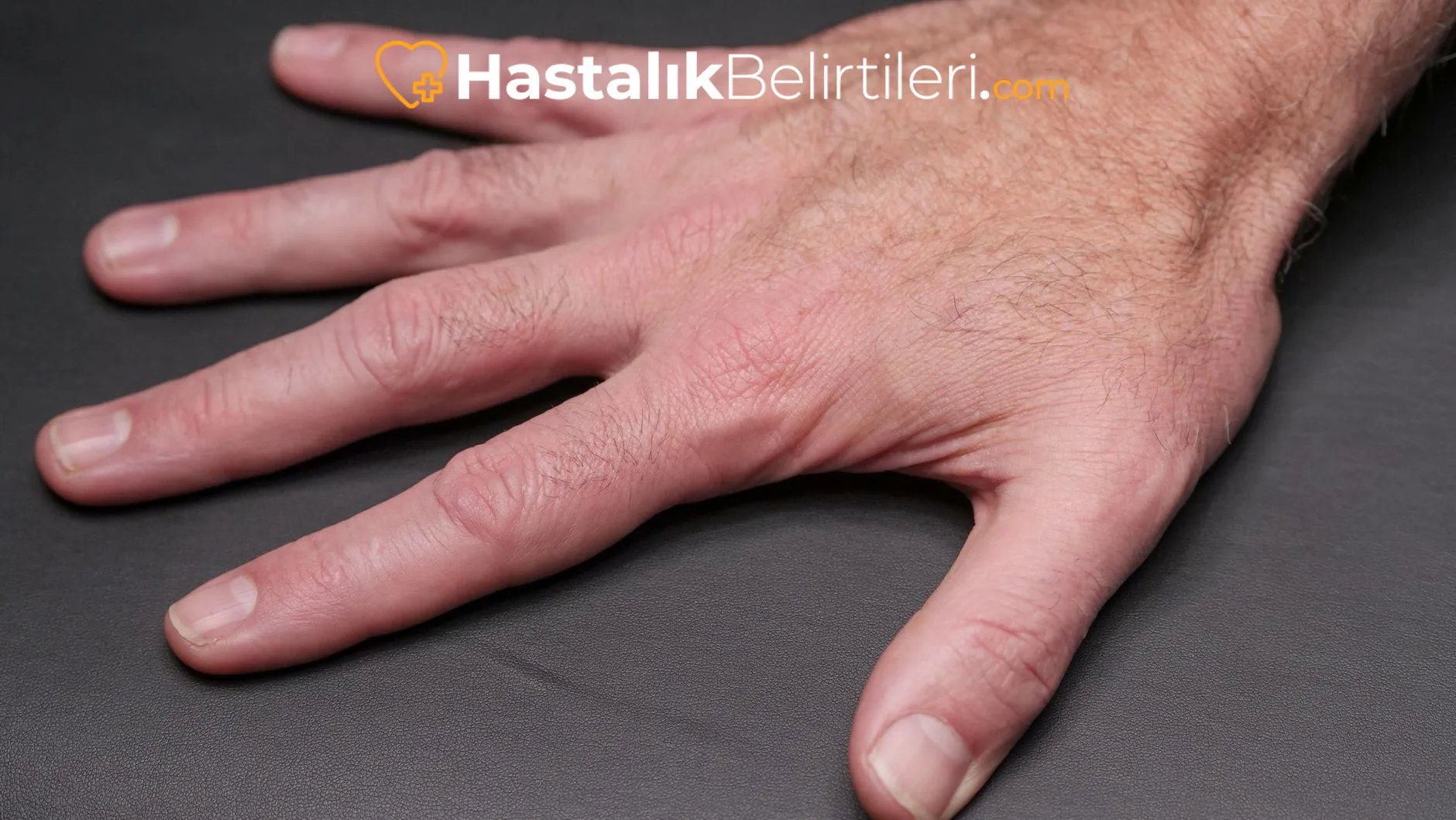 Nedeni olası: sinir basısı gösteren el çizimi
