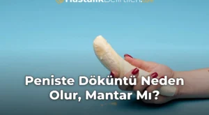 Peniste Döküntü Neden Olur, Mantar Mı?