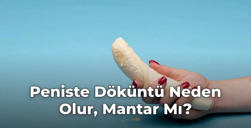 Peniste Döküntü Neden Olur, Mantar Mı?