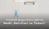 Prostat Büyümesi (BPH) Nedir, Belirtileri ve Tedavi?