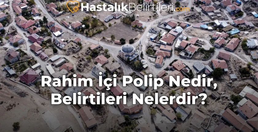 Rahim İçi Polip Nedir, Belirtileri Nelerdir? Rahim İçi Polip Nedir, Belirtileri Nelerdir?