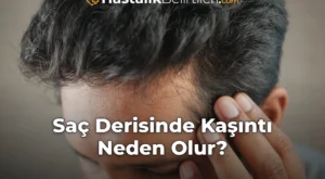 Saç Derisinde Kaşıntı Neden Olur?
