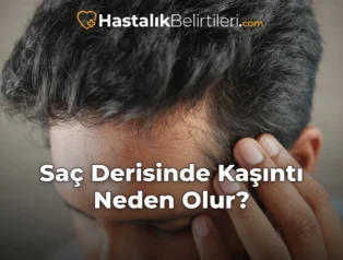 Saç Derisinde Kaşıntı Neden Olur?