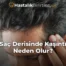 Saç Derisinde Kaşıntı Neden Olur?