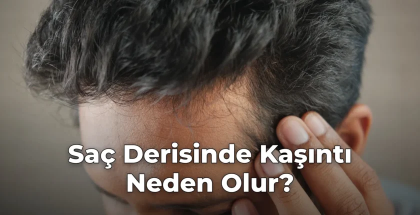 Saç Derisinde Kaşıntı Neden Olur?