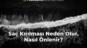 Saç Kırılması Neden Olur, Nasıl Önlenir?