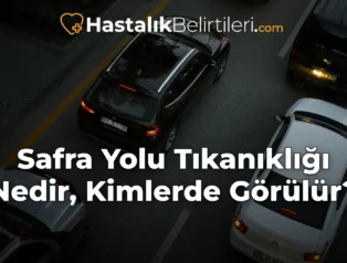 Safra Yolu Tıkanıklığı Nedir, Kimlerde Görülür?