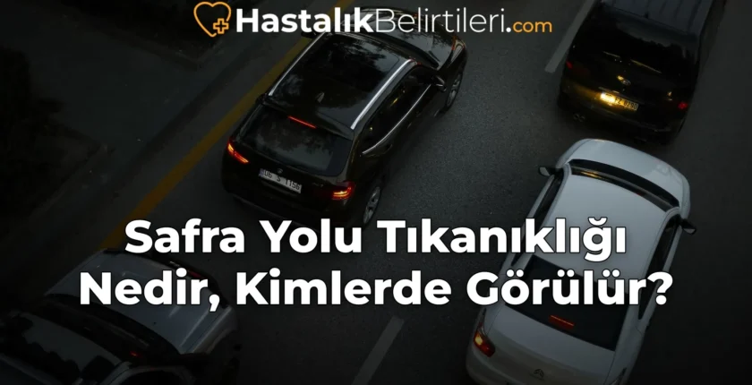 Safra Yolu Tıkanıklığı Nedir, Kimlerde Görülür?