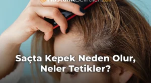 Saçta Kepek Neden Olur, Neler Tetikler?
