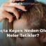 Saçta Kepek Neden Olur, Neler Tetikler?