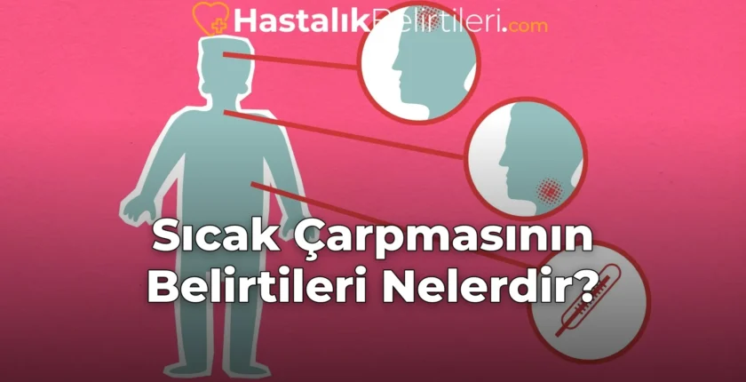 Sıcak Çarpmasının Belirtileri Nelerdir?