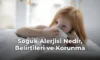 Soğuk Alerjisi Nedir, Belirtileri ve Korunma Soğuk Alerjisi Nedir, Belirtileri ve Korunma