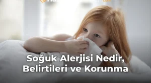 Soğuk Alerjisi Nedir, Belirtileri ve Korunma