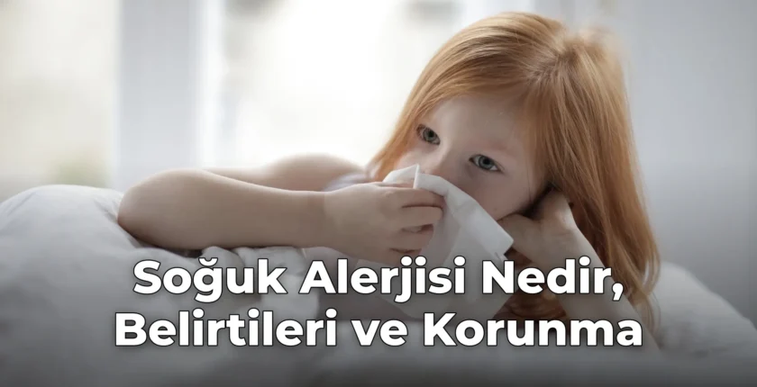Soğuk Alerjisi Nedir, Belirtileri ve Korunma Soğuk Alerjisi Nedir, Belirtileri ve Korunma