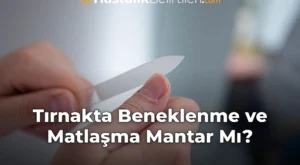 Tırnakta Beneklenme ve Matlaşma Mantar Mı?
