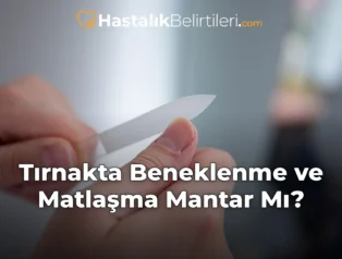 Tırnakta Beneklenme ve Matlaşma Mantar Mı?