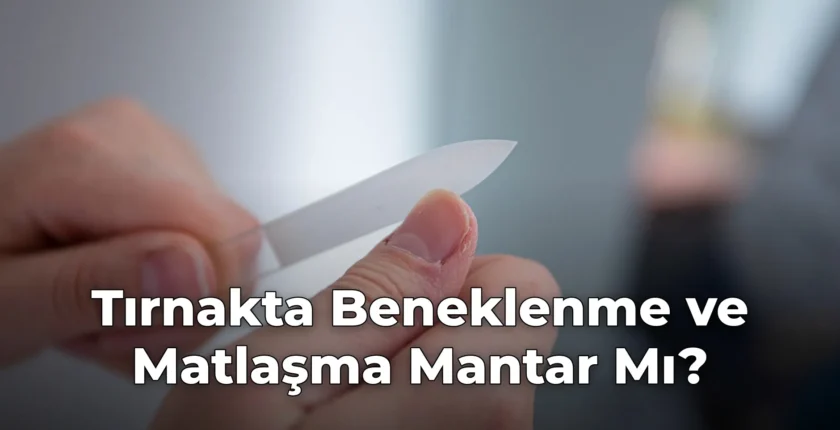 Tırnakta Beneklenme ve Matlaşma Mantar Mı?