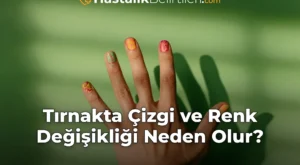 Tırnakta Çizgi ve Renk Değişikliği Neden Olur?