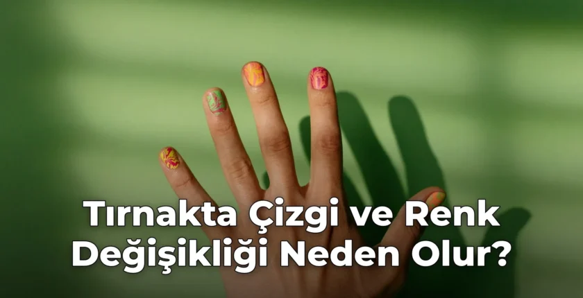 Tırnakta Çizgi ve Renk Değişikliği Neden Olur?