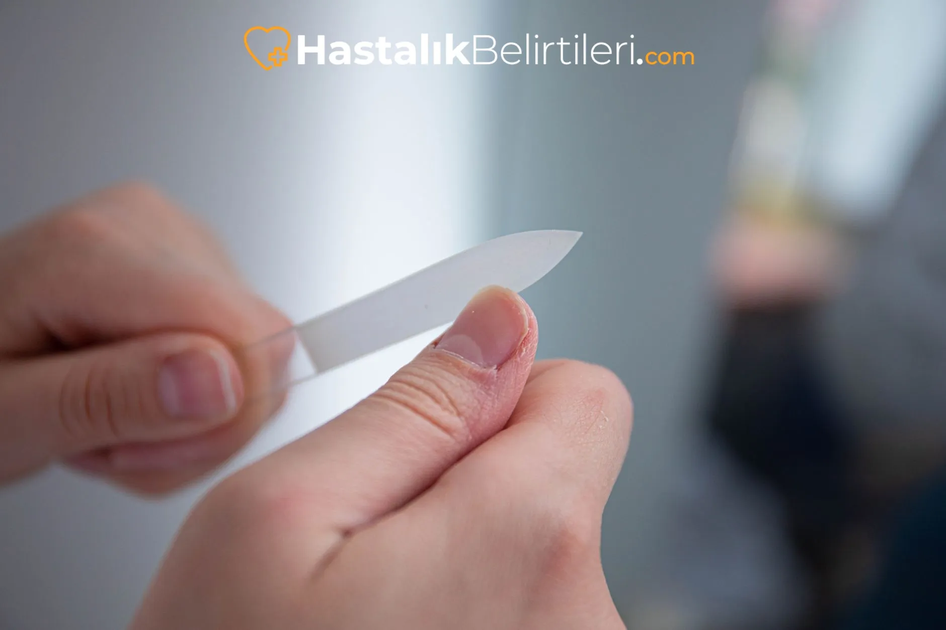 Tırnakta Sararma Neden Olur, Mantar mı? 3 tırnakta sararma neden olur