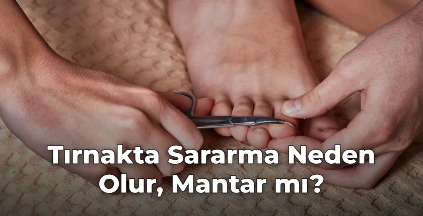 Tırnakta Sararma Neden Olur, Mantar mı?