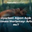 Uyurken Ağzın Açık Kalması Horlamayı Artırır mı?