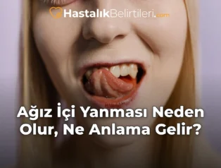 Ağız İçi Yanması Neden Olur, Ne Anlama Gelir?