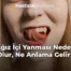 Ağız İçi Yanması Neden Olur, Ne Anlama Gelir?