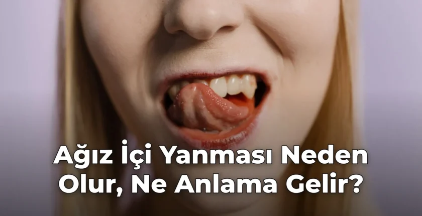 Ağız İçi Yanması Neden Olur, Ne Anlama Gelir?