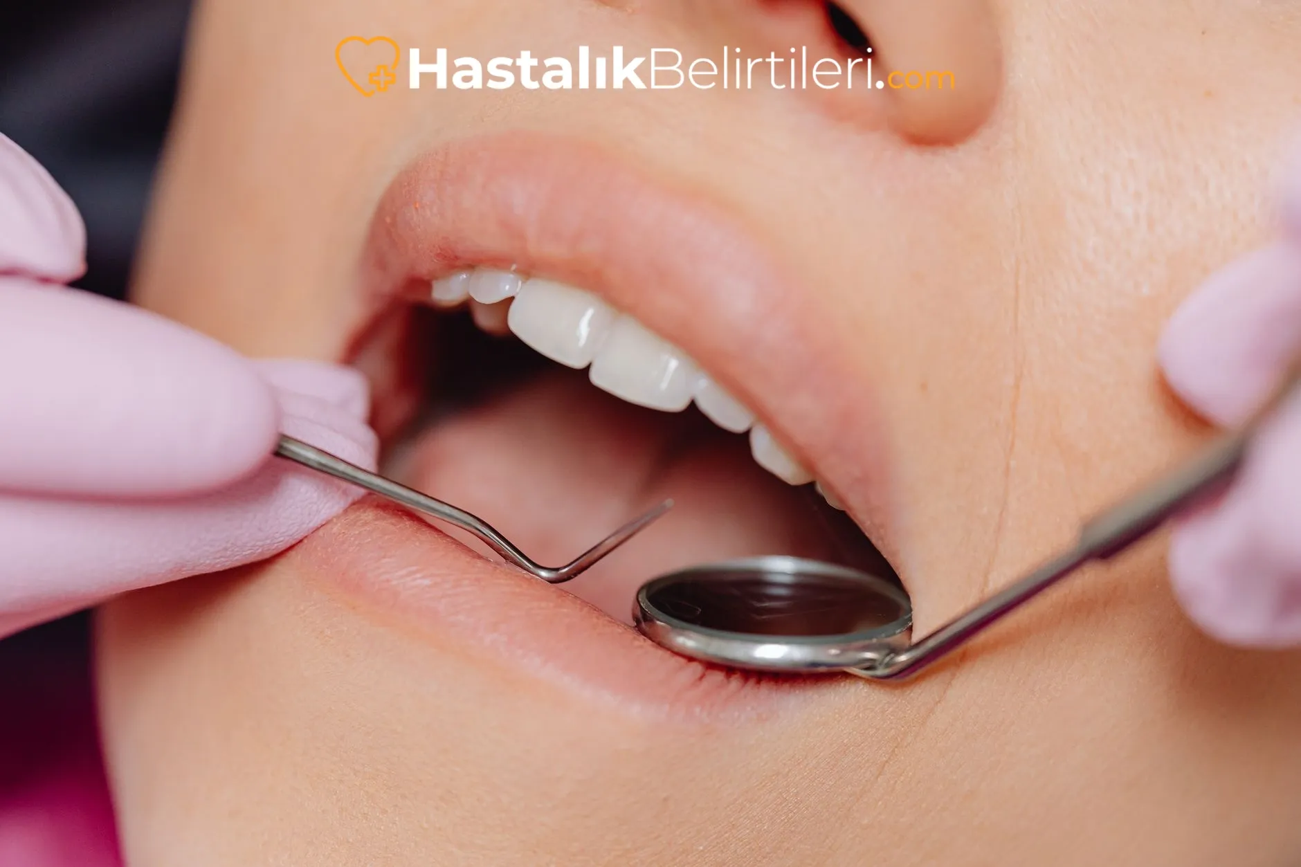 Ağız Kokusu Diş Eti Kanaması Neden Olur? 2 Diş hekimi muayenesi: diş eti kanaması kontrolü