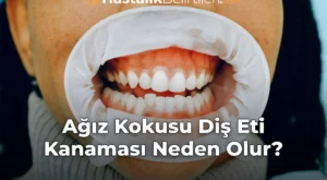 Ağız Kokusu Diş Eti Kanaması Neden Olur?