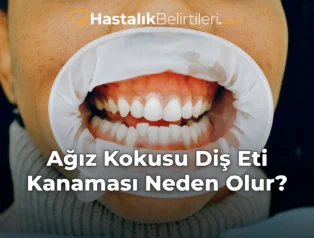 Ağız Kokusu Diş Eti Kanaması Neden Olur?