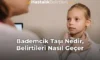Bademcik Taşı Nedir, Belirtileri Nasıl Geçer Bademcik Taşı Nedir, Belirtileri Nasıl Geçer