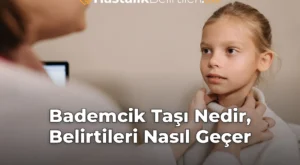 Bademcik Taşı Nedir, Belirtileri Nasıl Geçer
