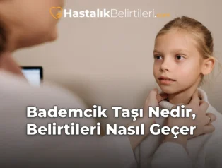 Bademcik Taşı Nedir, Belirtileri Nasıl Geçer