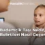 Bademcik Taşı Nedir, Belirtileri Nasıl Geçer
