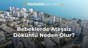 Bebeklerde Ateşsiz Döküntü Neden Olur?
