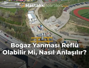Boğaz Yanması Reflü Olabilir Mi, Nasıl Anlaşılır?