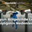 Boyun Bölgesinde Lenf Şişliğinin Nedenleri