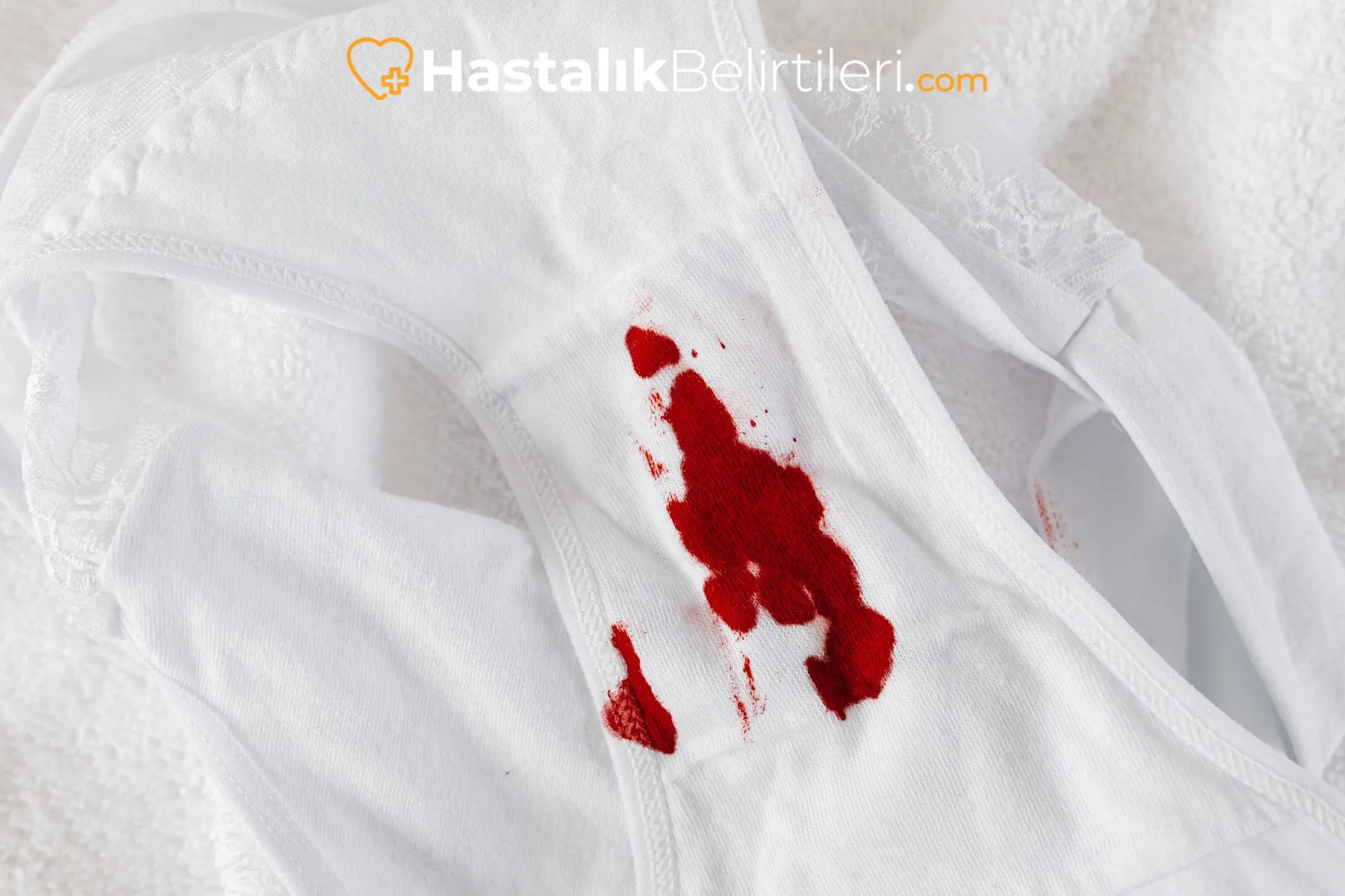 Burunda Kan Tadı En Sık Neden Olur? 4 Burun içi mukozada tahriş gösterimi, kırmızı damarlar
