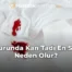 Burunda Kan Tadı En Sık Neden Olur?