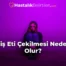 Diş Eti Çekilmesi Neden Olur?