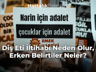 Diş Eti İltihabı Neden Olur, Erken Belirtiler Neler?