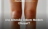 Diz Altında Ödem Neden Oluşur? Diz Altında Ödem Neden Oluşur?