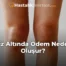 Diz Altında Ödem Neden Oluşur?