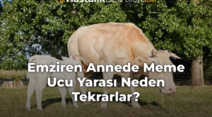 Emziren Annede Meme Ucu Yarası Neden Tekrarlar?