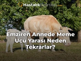 Emziren Annede Meme Ucu Yarası Neden Tekrarlar?