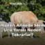 Emziren Annede Meme Ucu Yarası Neden Tekrarlar?