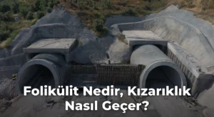 Folikülit Nedir, Kızarıklık Nasıl Geçer?