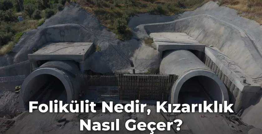 Folikülit Nedir, Kızarıklık Nasıl Geçer?